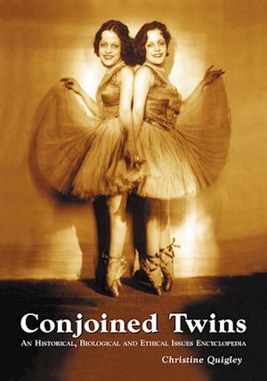 Conjoined Twins