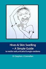 Hives & Skin Swelling a Simple Guide