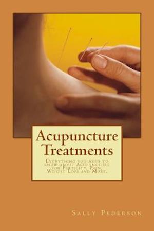 Acupuncture Treatments