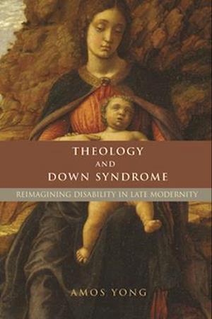 Theology and Down Syndrome