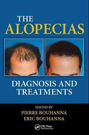 The Alopecias