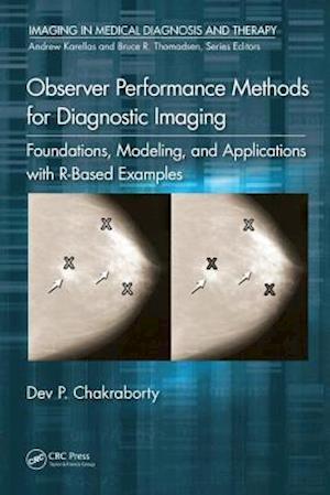 Observer Performance Methods for Diagnostic Imaging