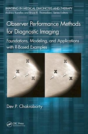 Observer Performance Methods for Diagnostic Imaging