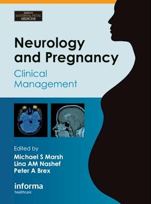 Neurology and Pregnancy