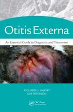 Otitis Externa