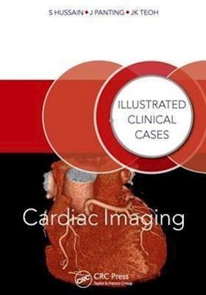 Cardiac Imaging