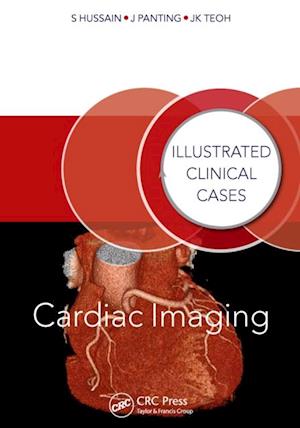 Cardiac Imaging