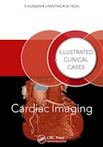 Cardiac Imaging