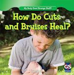 How Do Cuts and Bruises Heal?