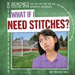 What If I Need Stitches?