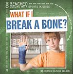 What If I Break a Bone?