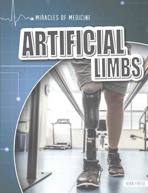 Artificial Limbs