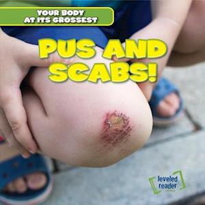 Pus and Scabs!