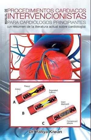 Manual de Procedimientos Cardiacos Intervencionistas Para Cardiologos Principiantes