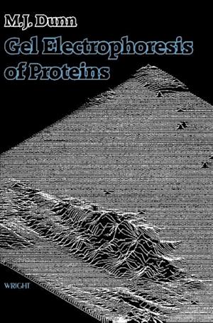 Gel Electrophoresis of Proteins