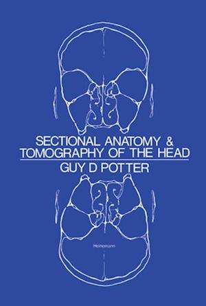 Sectional Anatomy and Tomography of the Head