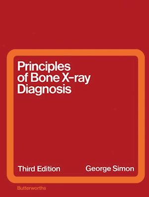 Principles of Bone X-Ray Diagnosis