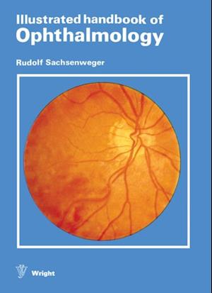 Illustrated Handbook of Ophthalmology