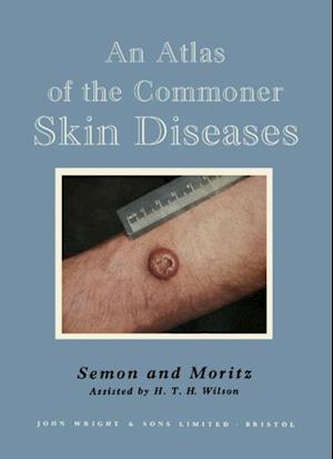 Atlas of the Commoner Skin Diseases