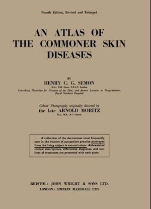 Atlas of the Commoner Skin Diseases