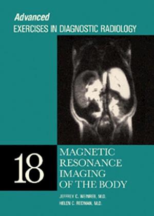 Magnetic Resonance Imaging of the Body