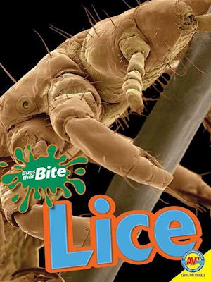 Lice