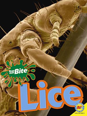 Lice