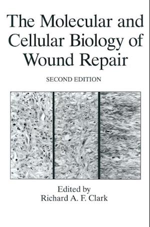 Molecular and Cellular Biology of Wound Repair