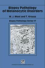 Biopsy Pathology of Melanocytic Disorders