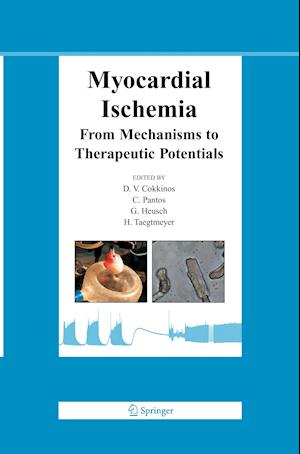 Myocardial Ischemia