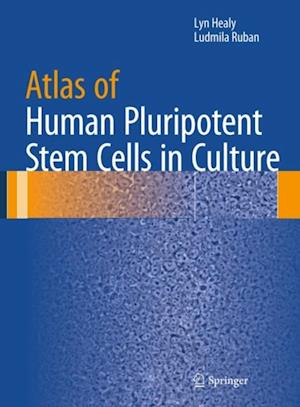 Atlas of Human Pluripotent Stem Cells in Culture