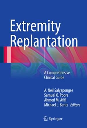 Extremity Replantation