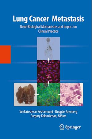 Lung Cancer Metastasis