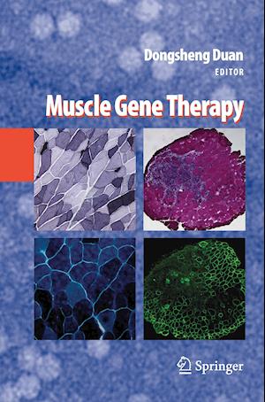 Muscle Gene Therapy