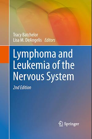 Lymphoma and Leukemia of the Nervous System