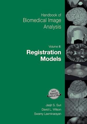 Handbook of Biomedical Image Analysis