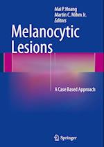 Melanocytic Lesions