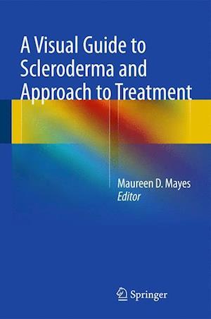 A Visual Guide to Scleroderma and Approach to Treatment