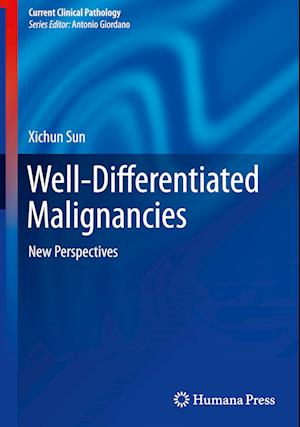 Well-Differentiated Malignancies