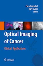 Optical Imaging of Cancer