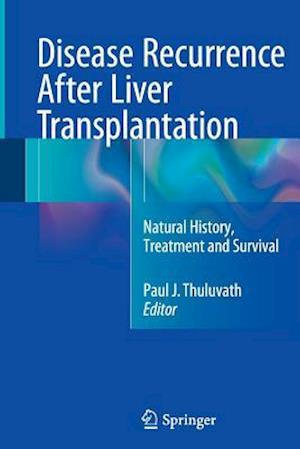 Disease Recurrence After Liver Transplantation