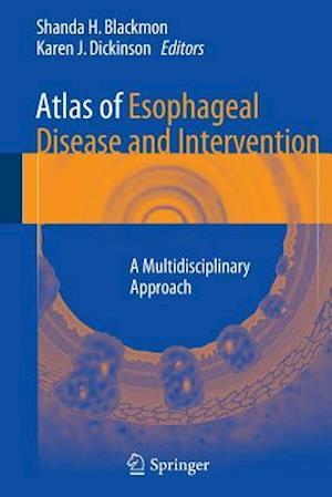 Atlas of Esophageal Disease and Intervention