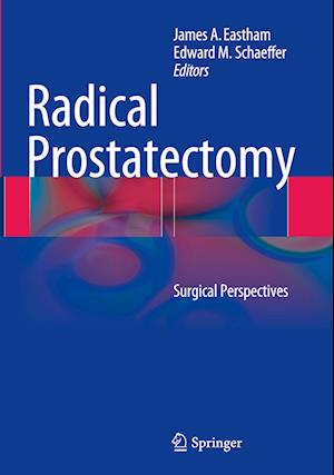 Radical Prostatectomy