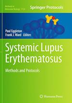 Systemic Lupus Erythematosus