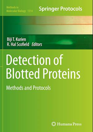 Detection of Blotted Proteins