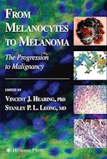 From Melanocytes to Melanoma