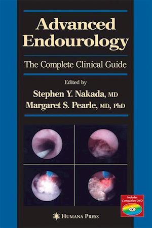 Advanced Endourology