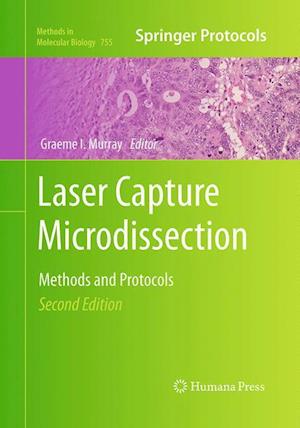 Laser Capture Microdissection