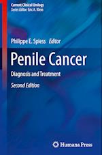 Penile Cancer