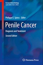 Penile Cancer